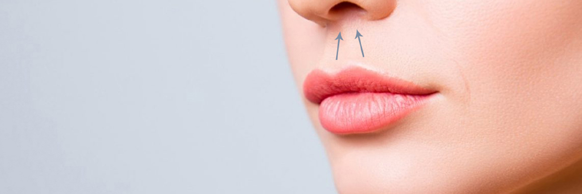 Lip-lift Nedir?